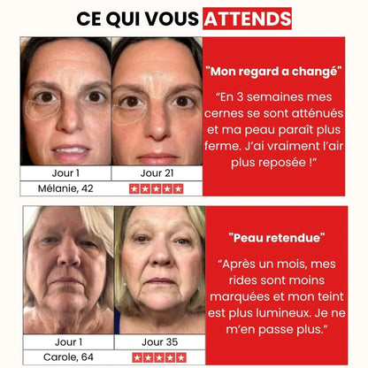 DermaPro™ – Appareil anti-rides 7-en-1