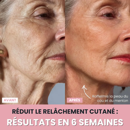 DermaPro™ – Appareil LED anti-rides 7-en-1