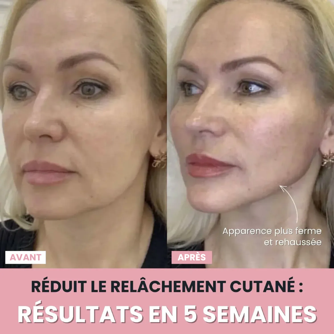 DermaPro™ – Appareil LED anti-rides 7-en-1