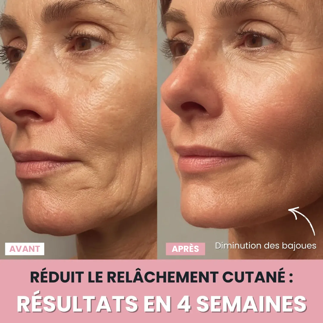 DermaPro™ – Appareil LED anti-rides 7-en-1