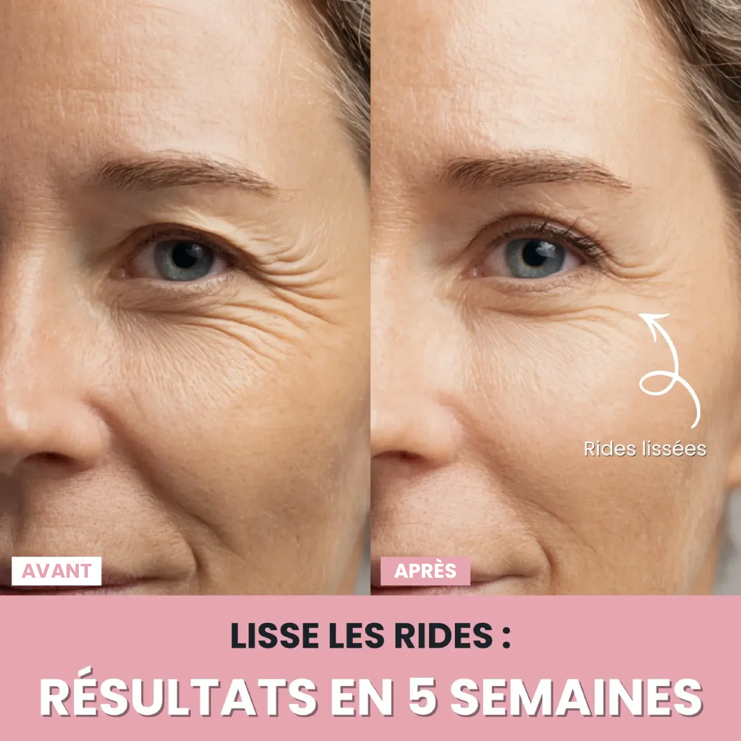 DermaPro™ – Appareil LED anti-rides 7-en-1