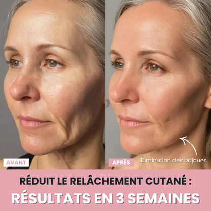 DermaPro™ – Appareil LED anti-rides 7-en-1