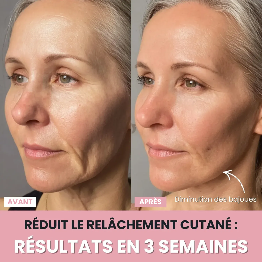 DermaPro™ – Appareil LED anti-rides 7-en-1