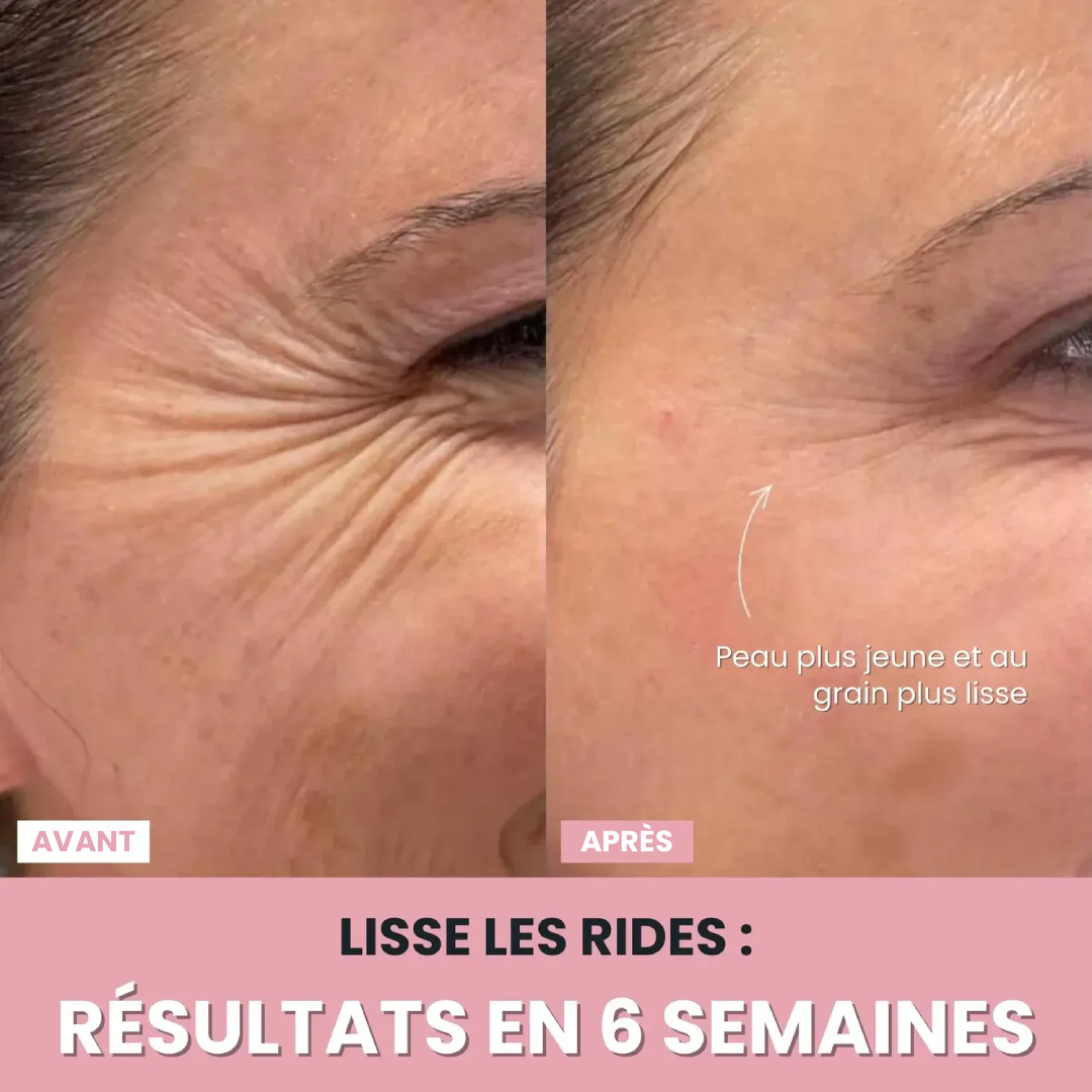 DermaPro™ – Appareil LED anti-rides 7-en-1