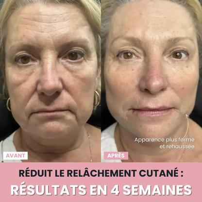DermaPro™ – Appareil LED anti-rides 7-en-1