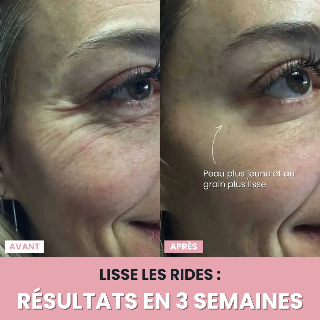 DermaPro™ – Appareil LED anti-rides 7-en-1