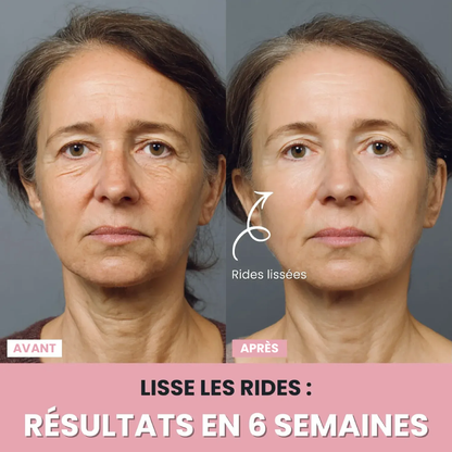 DermaPro™ – Appareil LED anti-rides 7-en-1