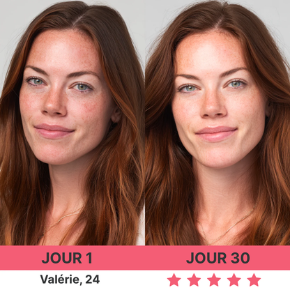 DermaPro™ – Appareil anti-rides 7-en-1