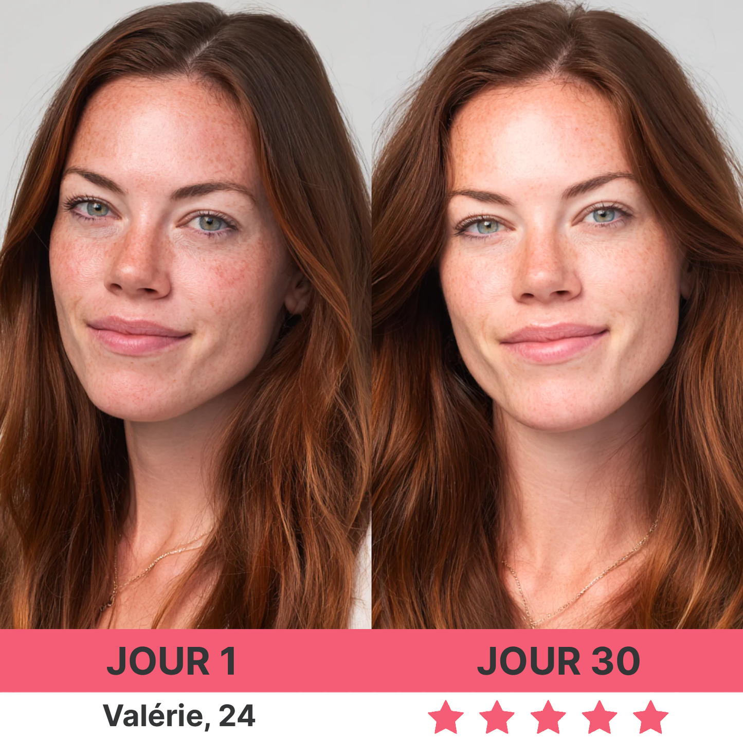 DermaPro™ – Appareil anti-rides 7-en-1